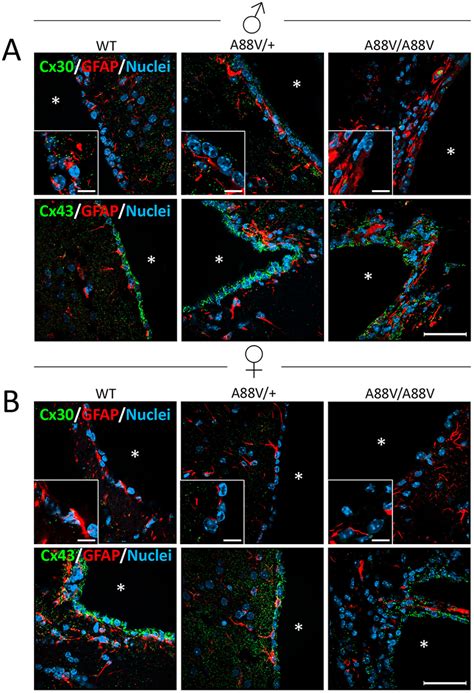 Cx30 And Cx43 Expression In Ventricle Lining Ependymal Cells Ab