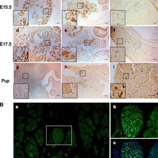 A Polyclonal Pax8 Antibody Reveals Expression Of The Transcription