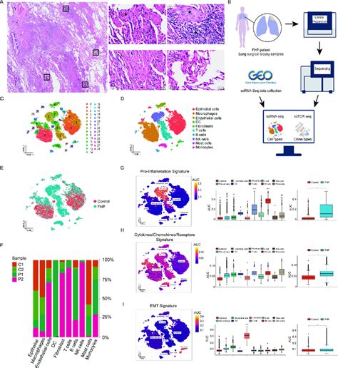 Study Design And Single Cell Transcriptional Profiling Of Lung Cells A