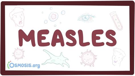 Measles Causes Symptoms Diagnosis Treatment Pathology Youtube