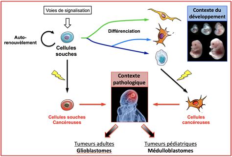 Cellules Souches Et Gliomes CRCL