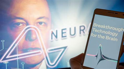 Elon Musk’s Neuralink Startup Receives Fda Approval For First In Human Brain Chip Implant