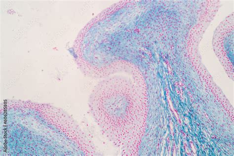 Showing Light Micrograph Of The Adrenal Gland And Urinary Bladder Human