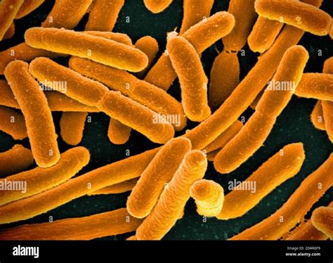 Coloured Scanning Electron Micrograph Sem Escherichia Coli Are Gram