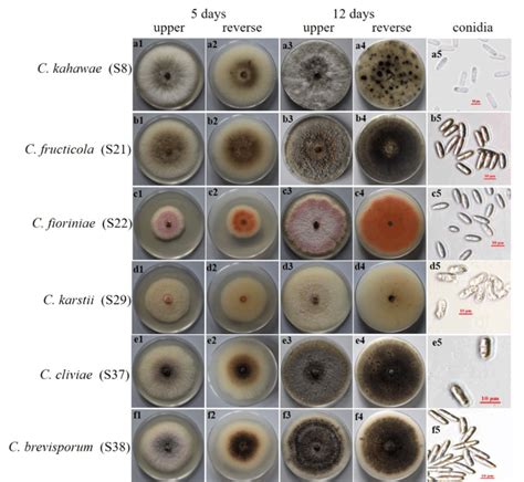 Morphological And Cultural Traits Of Colletotrichum Species Isolated