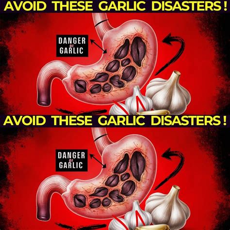 Garlic Usage Tips: Avoid These Common Errors
