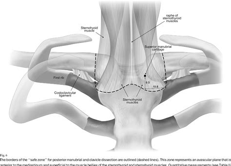 Figure 2 From Surgical Anatomy Of The Sternoclavicular Joint A