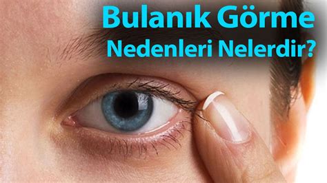 Bulan K G Rme Nedenleri Nelerdir