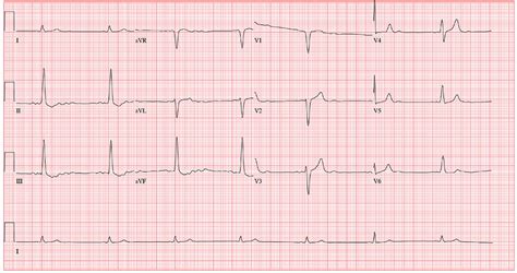 vital clue   problem clinician reviews
