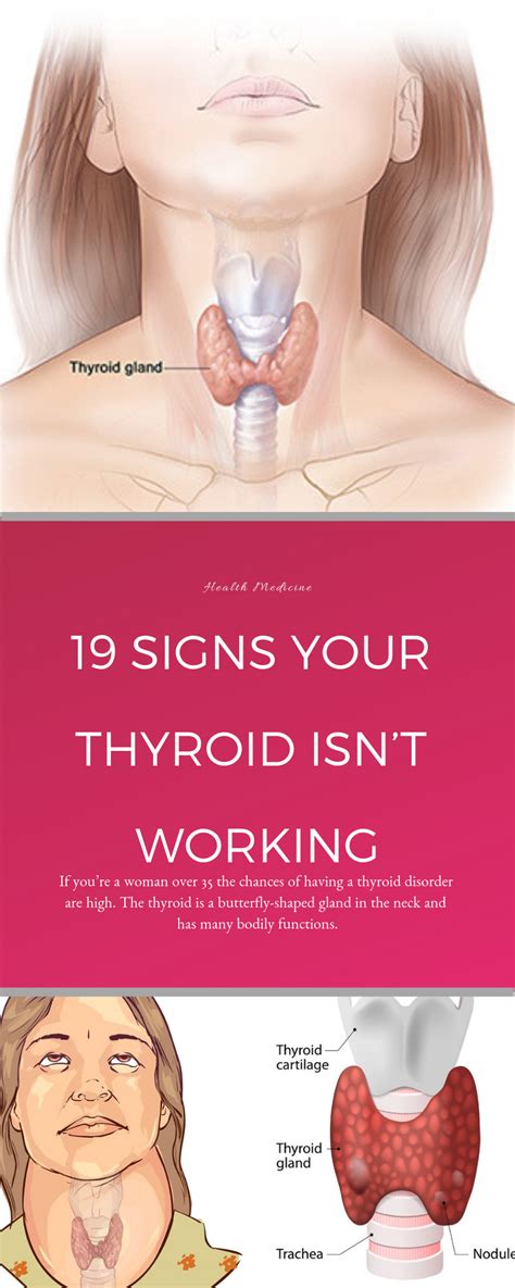 19 Signs Your Thyroid Isnt Working Thyroid Disorders Thyroid Hyperthyrodism