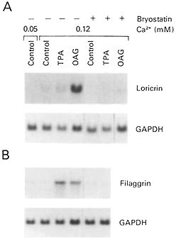 PKC Activation Enhances Expression Of MRNA Encoding The Granular Cell