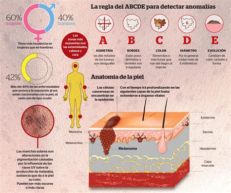 Cáncer De Piel El Terror Del Verano