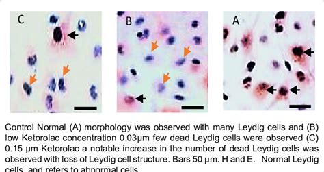 Representative Light Micrographs Of Buck Testicular Leydig Cells