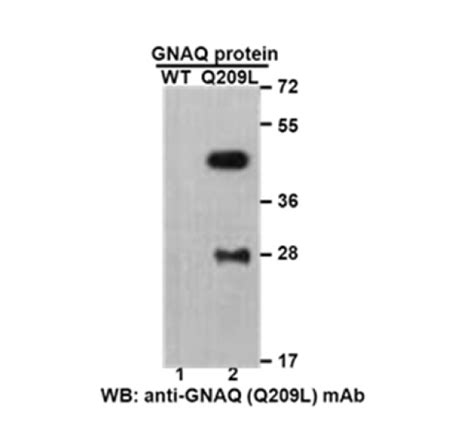 Gαq Q209L 小鼠单抗 费斯德 GTP酶和癌基因产品