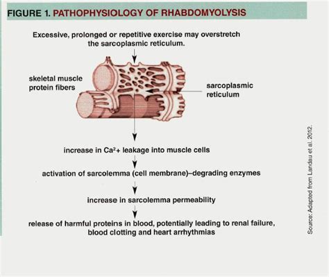 Rhabdomyolysis Physiopedia