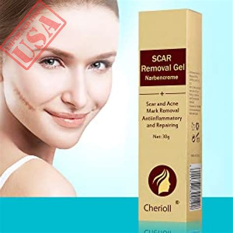 Scar Cream Acne Scar Removal Creamacne Spots Treatmentstretch Marks