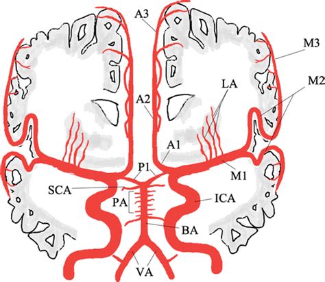 Time Of Flight Intracranial Mra At T Versus T Versus T