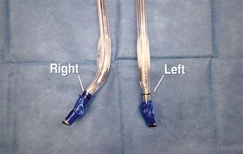 Placement Of A Double Lumen Endotracheal Tube Nejm