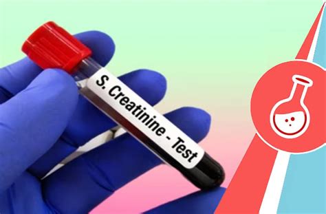 Book S Creatinine Test Off On Serum Creatinine Test Price