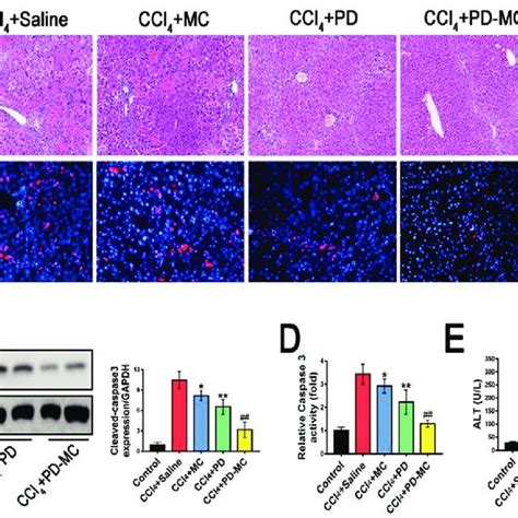 Pd‐mc Improved Liver Fibrosis In Ccl4 Induced Mice A Representative