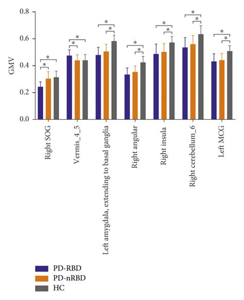 The Significant Differences Of Gray Matter Volume Gmv Between The Download Scientific Diagram