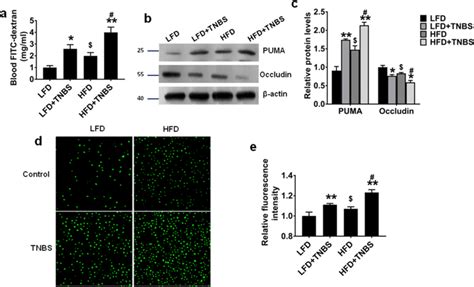 Obesity Enhances Intestinal Epithelial Barrier Dysfunction And Cellular Download Scientific