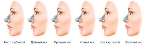 Пластика Носа До И После Фото Женщины — New-Freepik.Ru