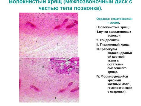 Хрящевая и костная ткань, остеогенез - презентация онлайн