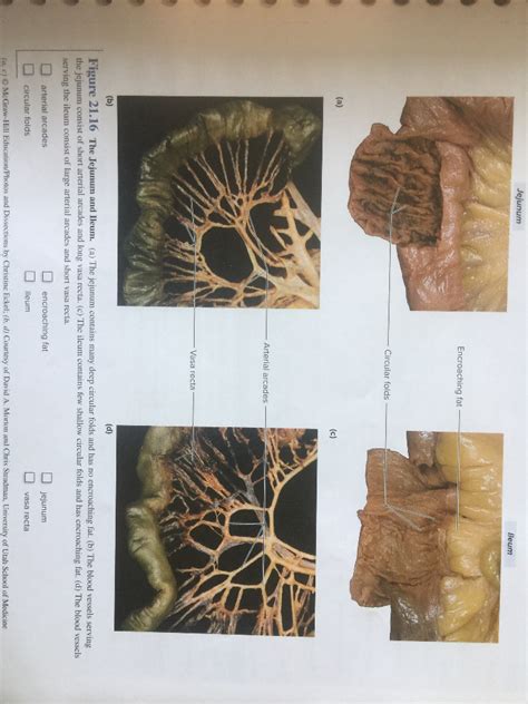 Anatomy Of The Small Intestine Jejunum And Ileum 40 OFF