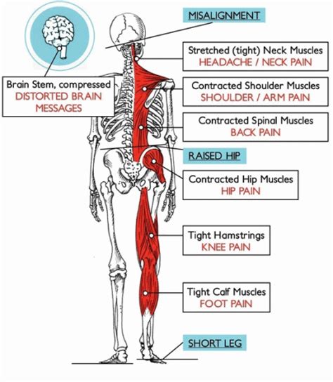 What Is Atlas Orthogonal Ao Peak Atlas Chiropractic