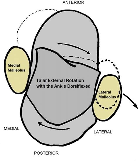 With The Ankle In Dorsiflexion An External Rotation Force On The Foot