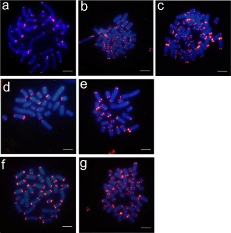 Fluorescence In Situ Hybridization