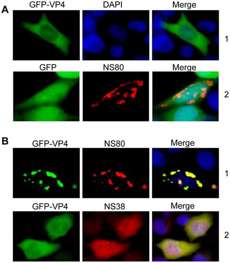 Fluorescence Microscope Or If Analysis Of Vero Cells Transfected With