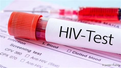 Aids Und Hiv Symptome Und Behandlung Netdoktor