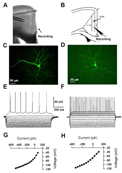 Morphological And Electrophysiological Properties Of Interneurons And