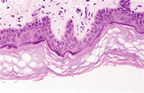 A Microscope Image Of The Epidermis The Epidermis Is Composed Of Four