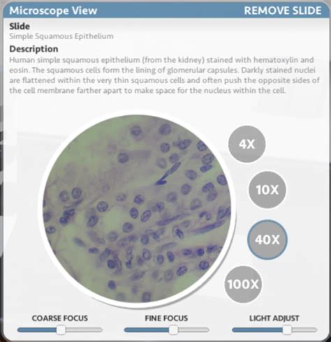 Answered Describe What The ‘simple Squamous Bartleby