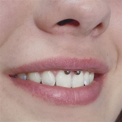 Smiley Piercing Perforaciones