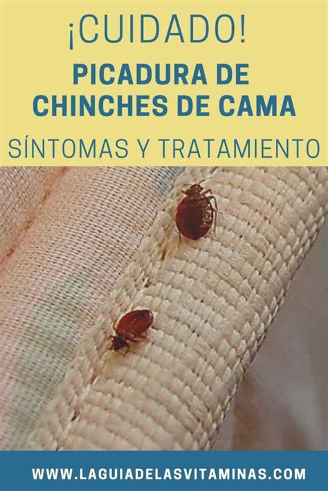 Picadura de chinches de cama síntomas y tratamientos La Guía de las