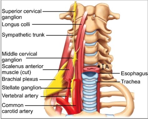 Stellate Ganglion Block OpenAnesthesia