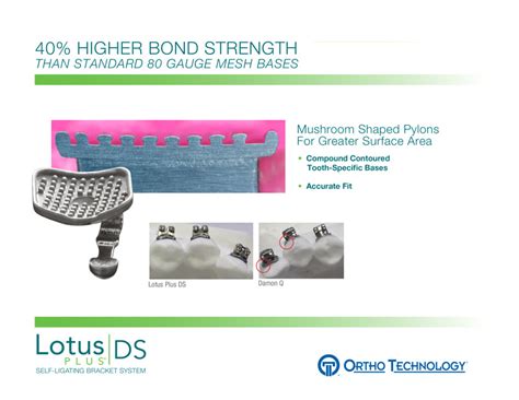 Lotus Plus DS Flipbook Ortho Technology