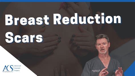 Plastic Surgeon Explains If Your Breast Reduction Surgery Will Leave A