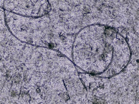 Morgellons And Lyme Are Infestations Of Parasitic Nematomorphs Your