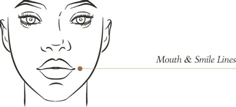Smile Lines Danvers Ma Roddy Medspa