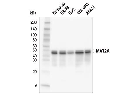 MAT2A E5I7C Rabbit MAb Cell Signaling Technology