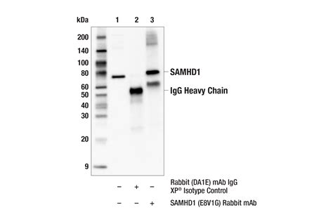 SAMHD1 E8V1G Rabbit MAb Cell Signaling Technology