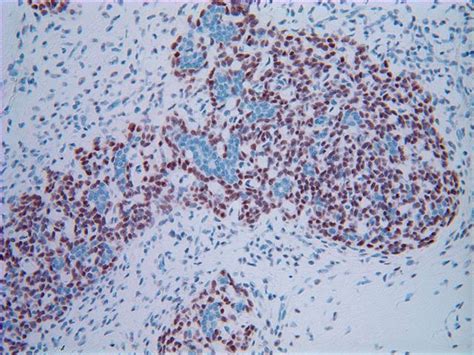 Pathology Outlines P63