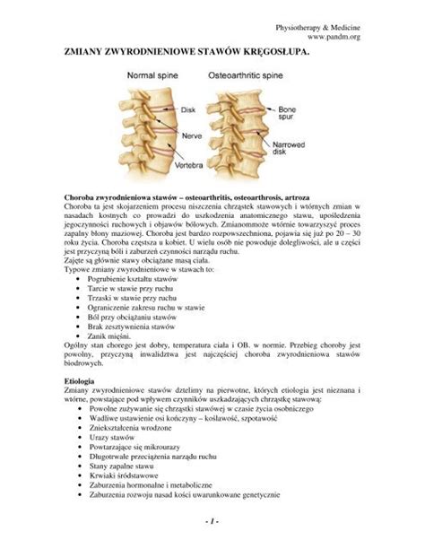 Zmiany Zwyrodnieniowe Staw W Kr Gos Upa Pandm