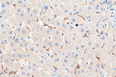 FcRn Mouse Monoclonal Antibody United Bio Research