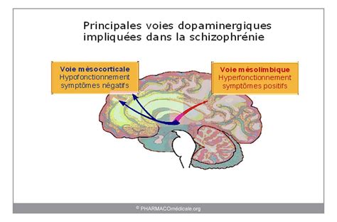 Que doit on surveiller après une IVG médicamenteuse Amiform